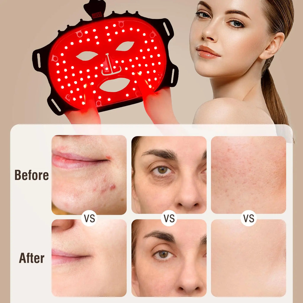 LED face mask with before and after effects on skin shown on a beige background