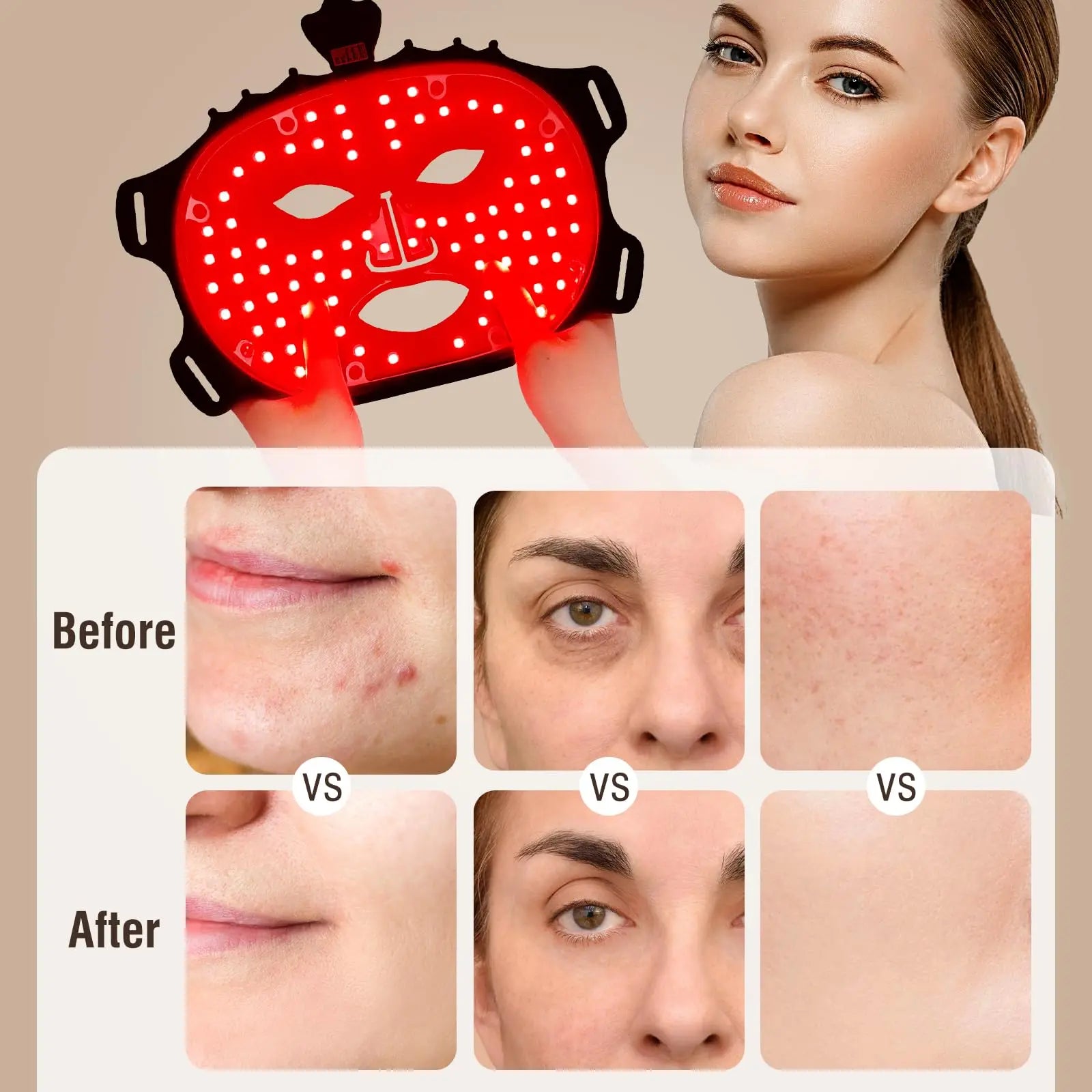 LED face mask with before and after effects on skin shown on a beige background